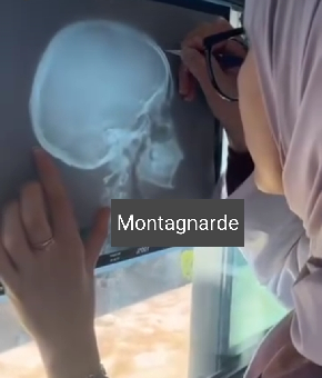 parler en toute simplicité